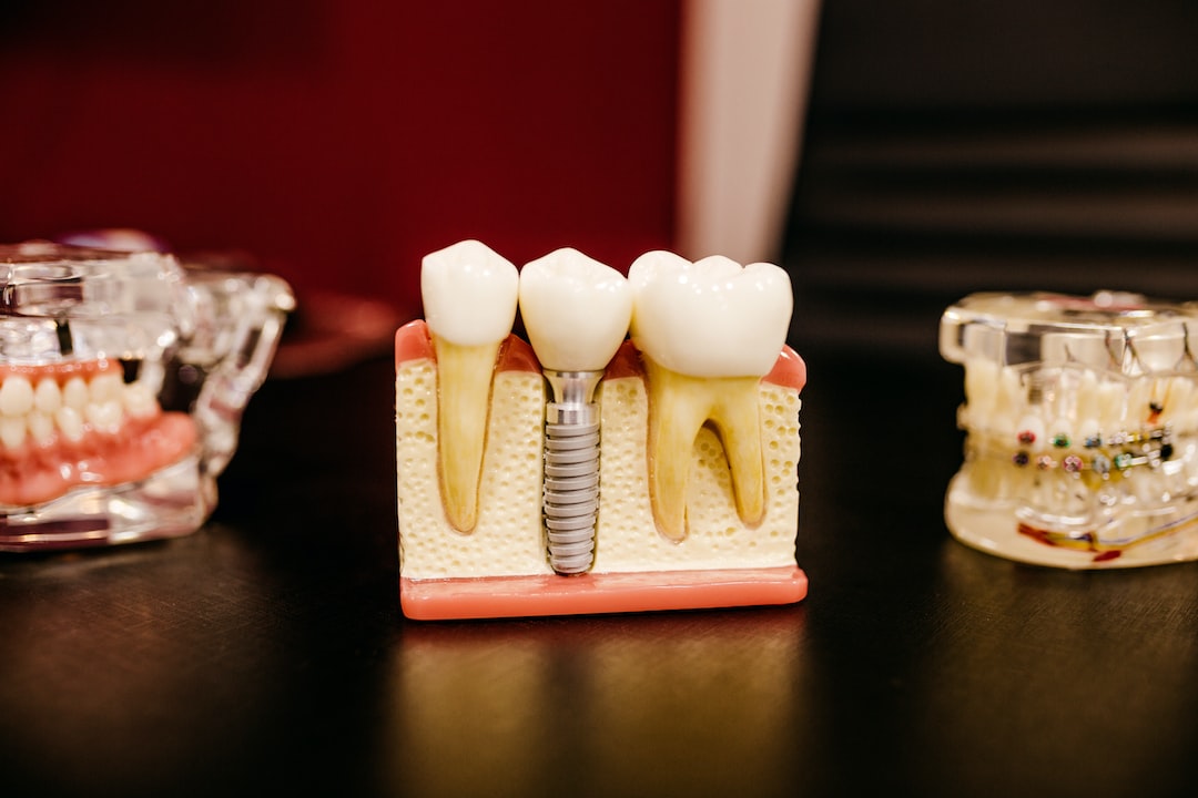 implant939-35075